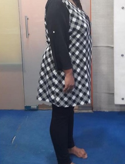 after obesity treatment slim fat loss ofy clinics dietician nutrionist india