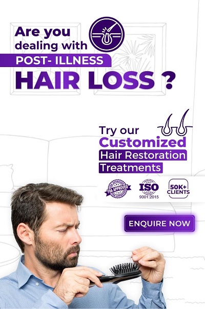 hair-loss-treatment-prp-for-men-cost-near-me-in-india-ofy-clinics-chhindwara-surat-nagpur-raipur-bhopal