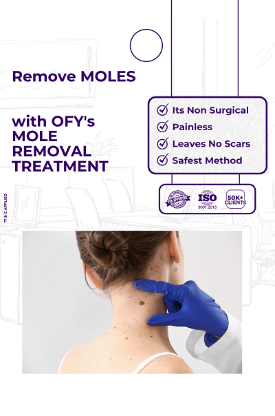 mole removal treatment painless ofy skin clinics in surat chhindwara raipur nagpur bhopal india
