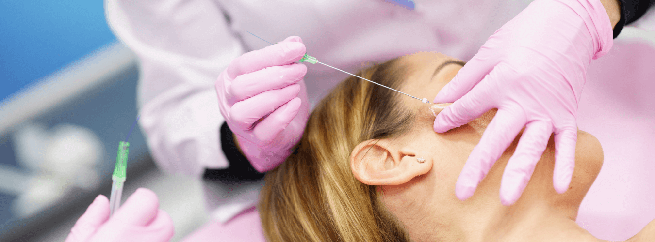 threads treatment eyebrow jaw face cheeks lift ofy clinics chhindwara surat raipur nagpur bhopal
