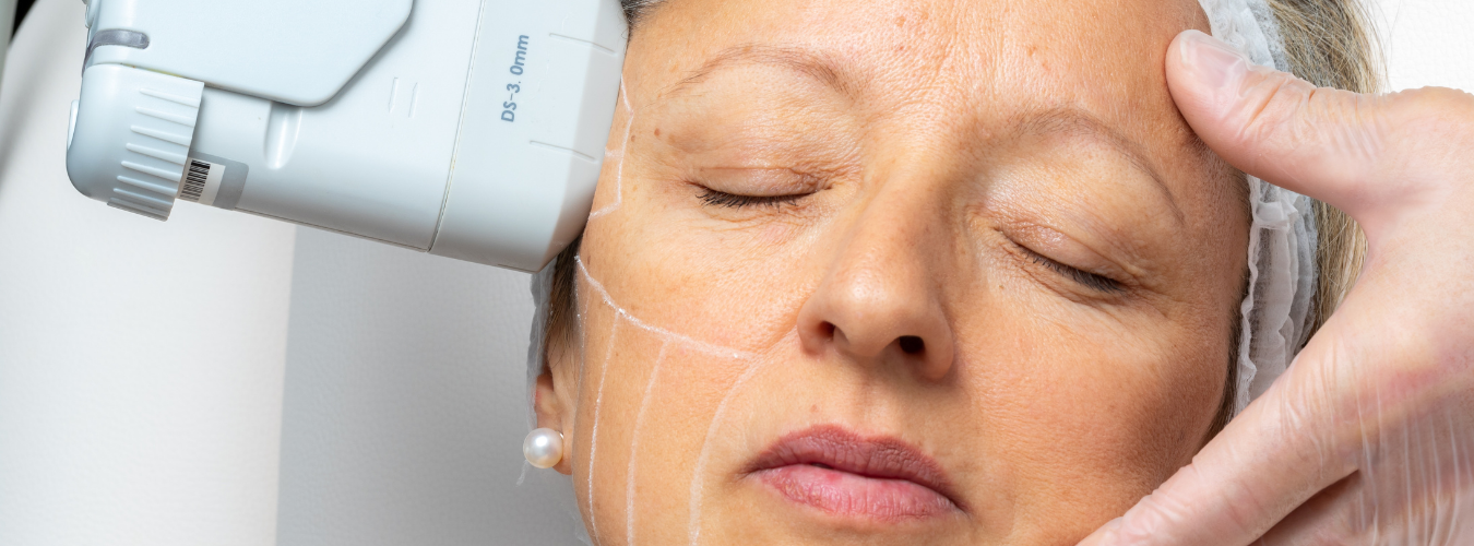 ultrasound hifu treatment in surat indore chhindwara bhopal raipur nagpur best dermatologist ofy clinics near me